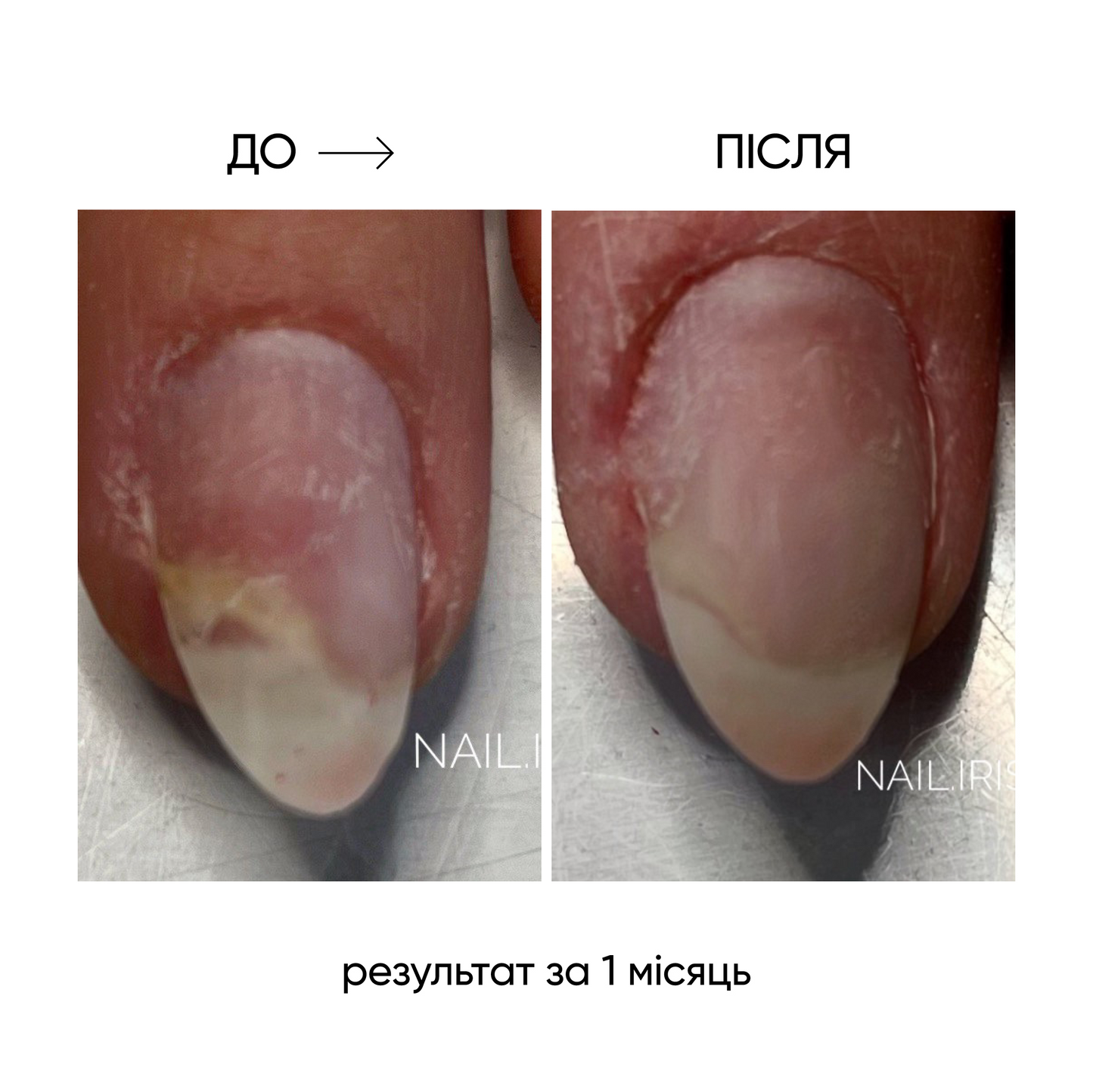 NAILSOFTHEDAY ONISTOP – aceite regenerador, 8 ml