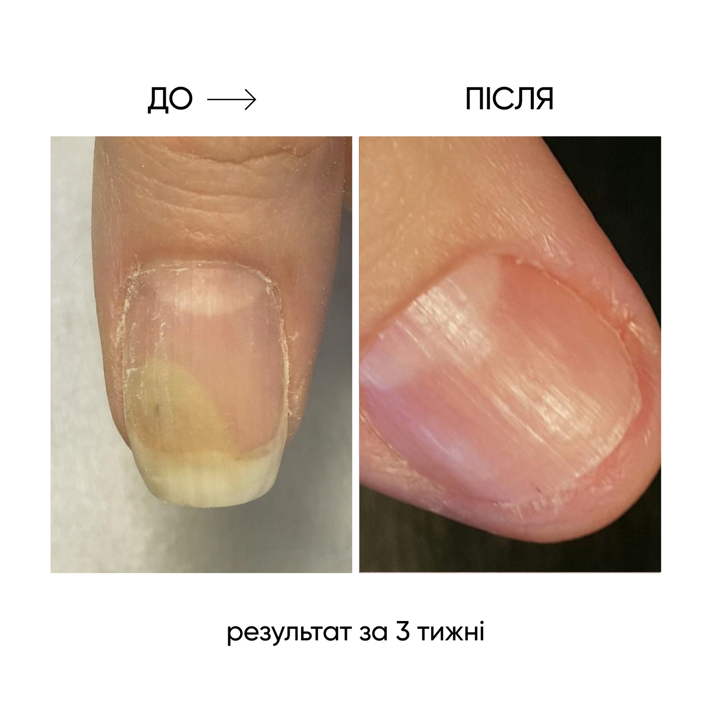 NAILSOFTHEDAY ONISTOP – aceite regenerador, 8 ml