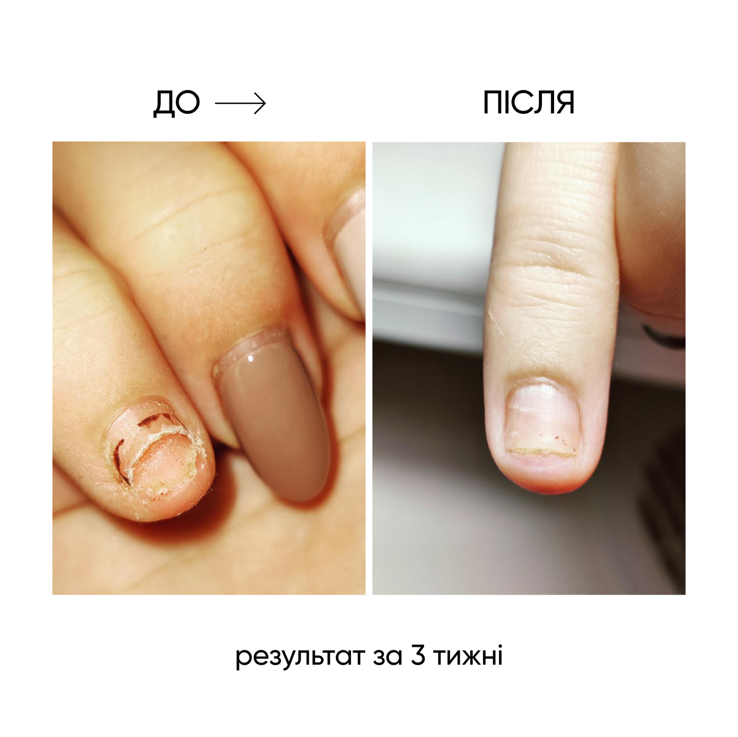 NAILSOFTHEDAY ONISTOP – aceite regenerador, 8 ml