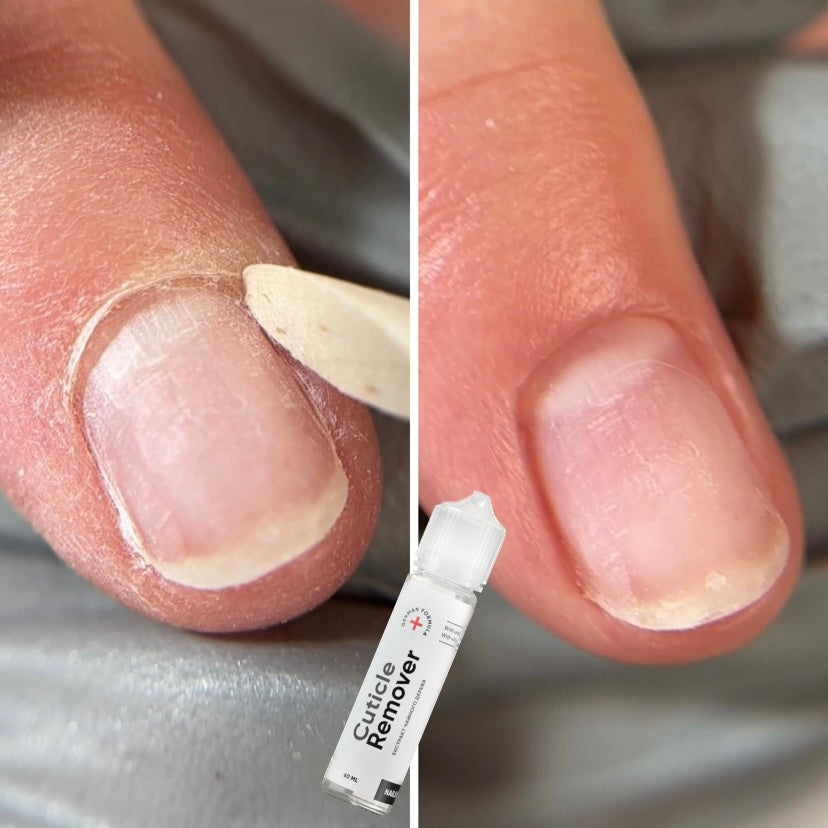 NAILSOFTHEDAY Cuticle Remover – removedor de cutículas regenerador para manicura y pedicura (con urea), 60 ml