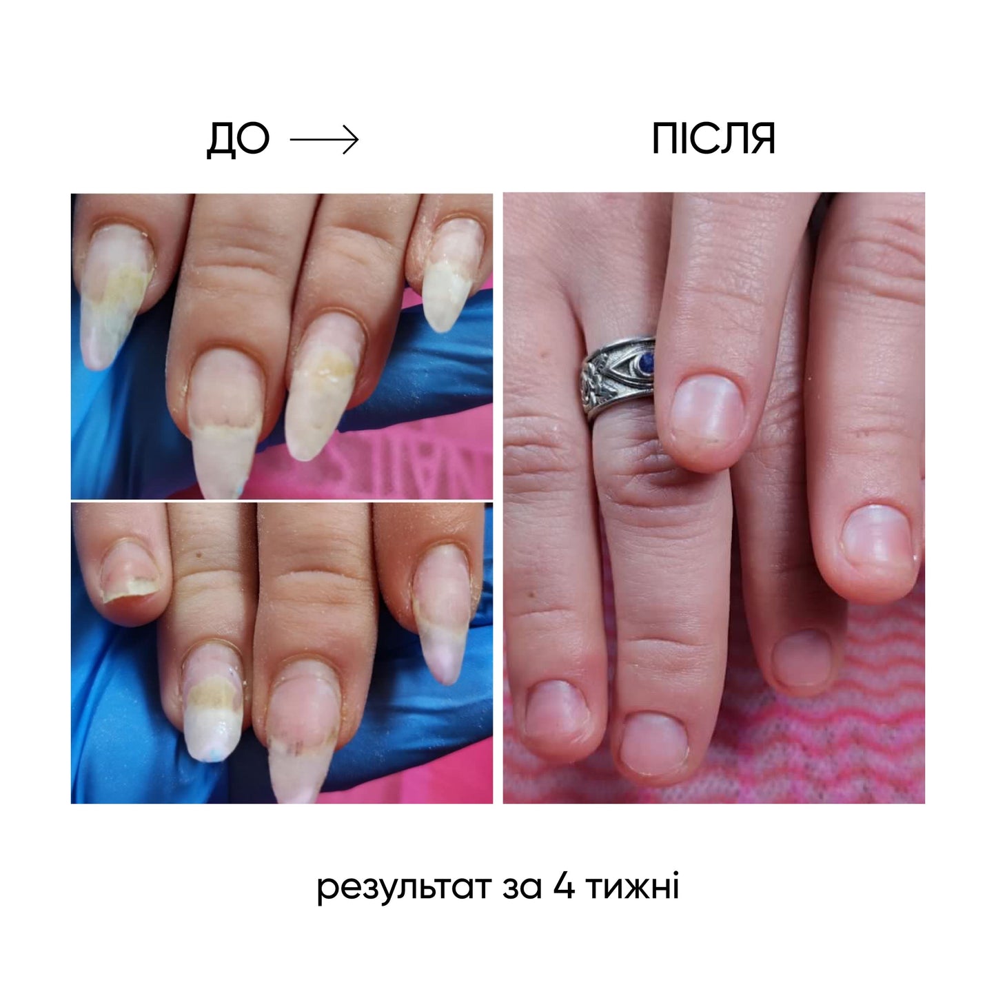 NAILSOFTHEDAY ONISTOP – aceite regenerador, 8 ml