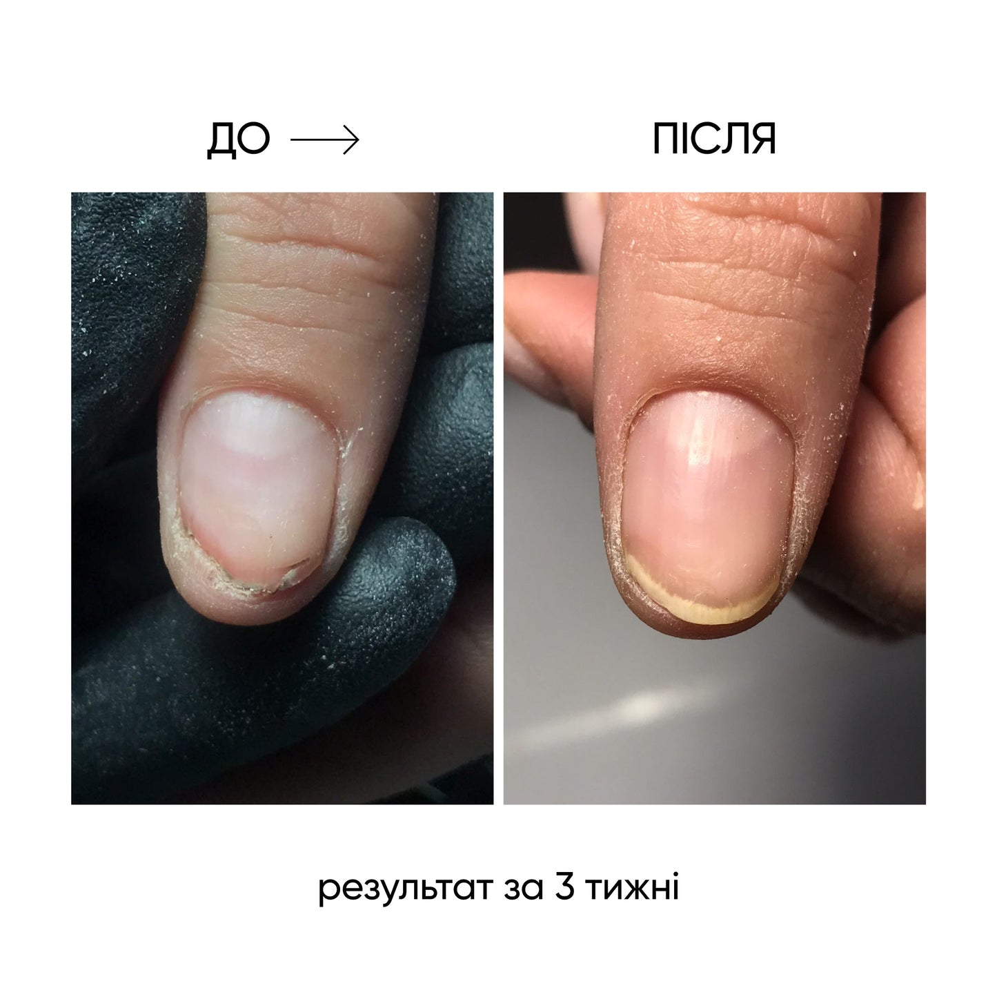 NAILSOFTHEDAY ONISTOP – aceite regenerador, 8 ml