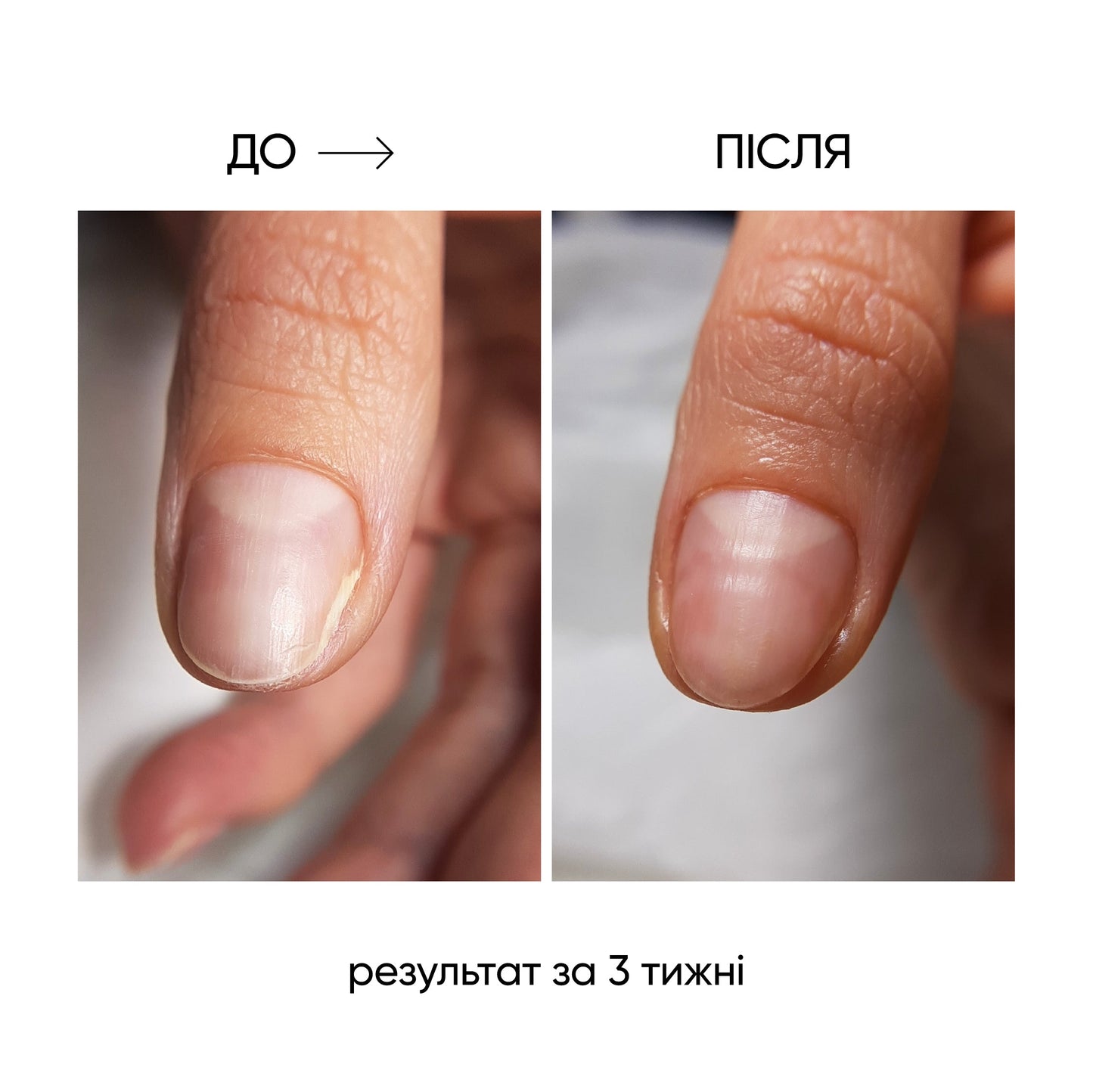 NAILSOFTHEDAY ONISTOP – aceite regenerador, 8 ml