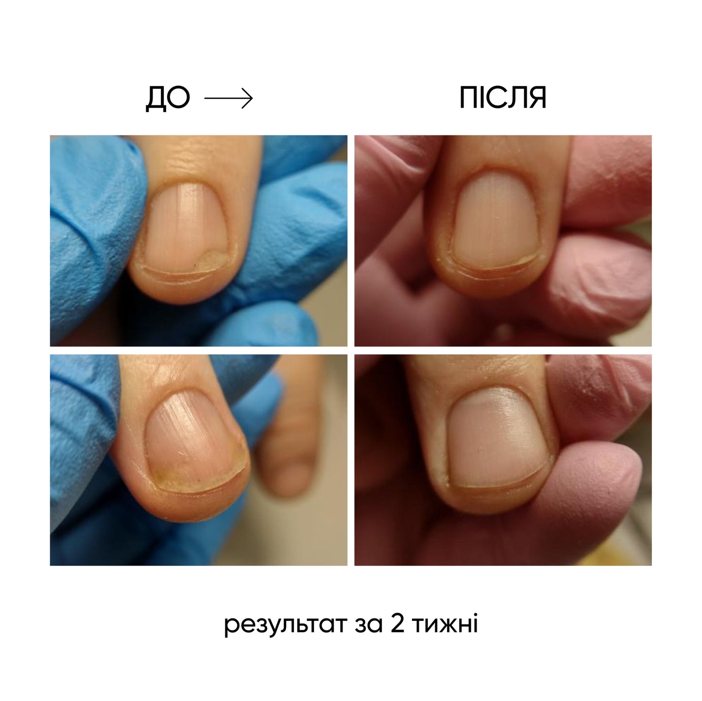 NAILSOFTHEDAY ONISTOP – aceite regenerador, 8 ml