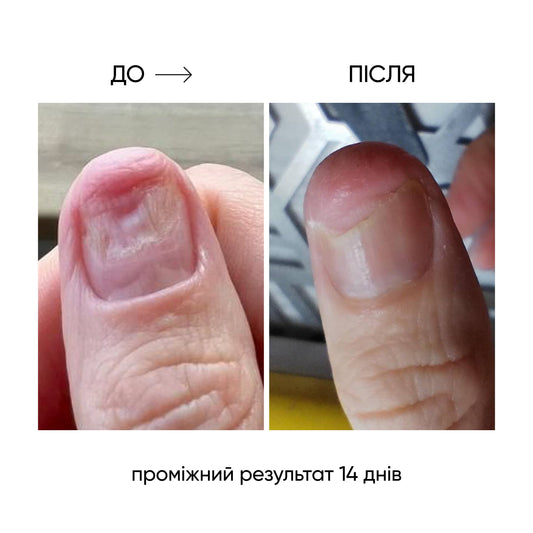 NAILSOFTHEDAY ONISTOP – aceite regenerador, 8 ml