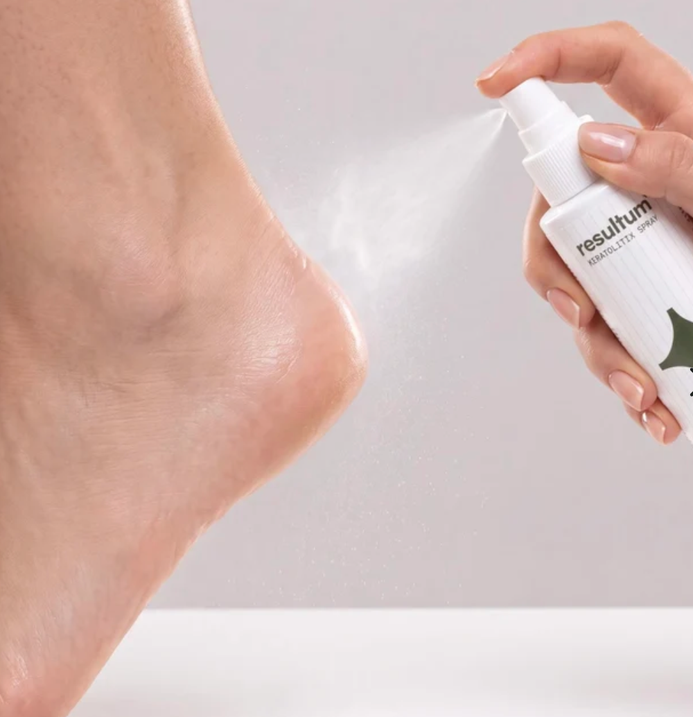 Resultum Keratolitix Spray – Queratolítico líquido en spray con Urea 20%, 150 ml