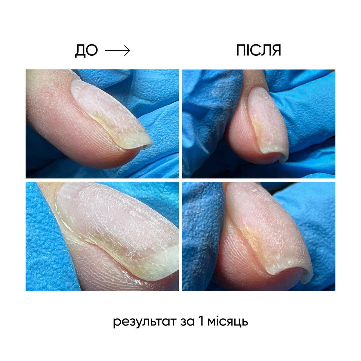 NAILSOFTHEDAY ONISTOP – Aceite regenerador, 8 ml