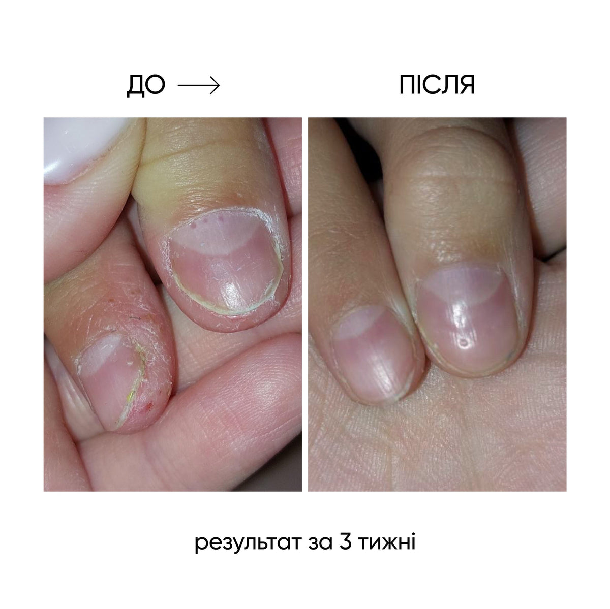 NAILSOFTHEDAY ONISTOP – Aceite regenerador, 8 ml